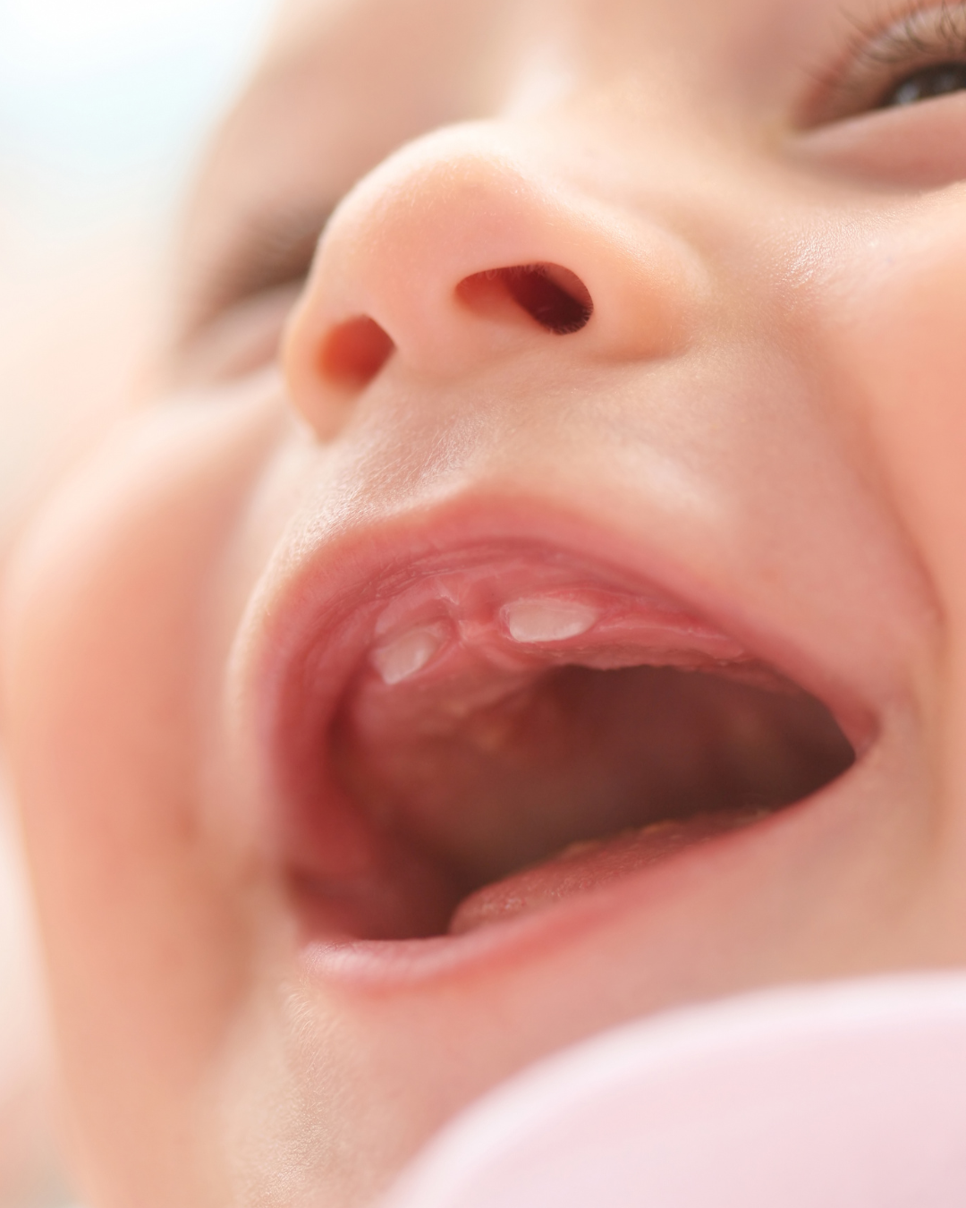 Close-up of baby teeth emerging from gums – infant oral health and early dental development.