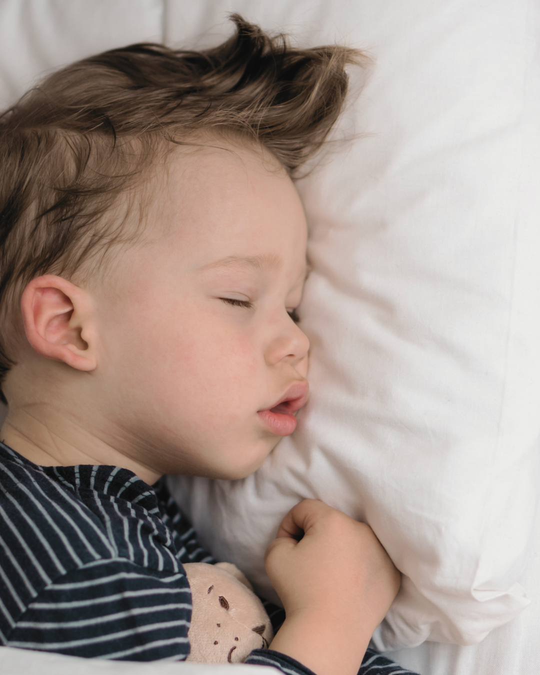Young child sleeping with their mouth open, illustrating mouth breathing as a sign of Sleep Disordered Breathing.